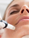 Microneedling, Gosforth, Newcastle Upon Tyne