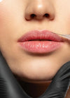 Lip Fillers 0.5ml